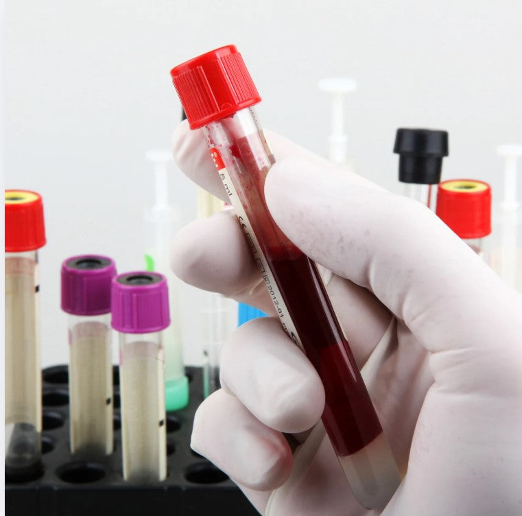 CambiSEQ
