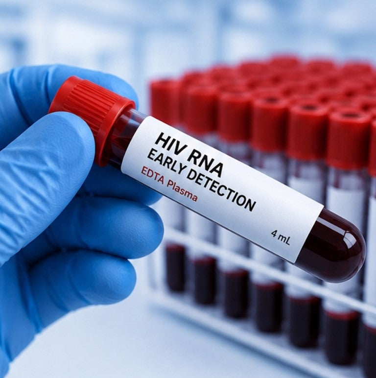 HIV RNA Early Detection