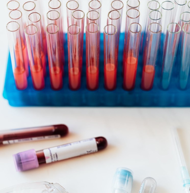 Lyme CD57+ Cells