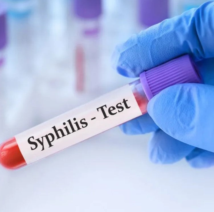 Syphilis Test