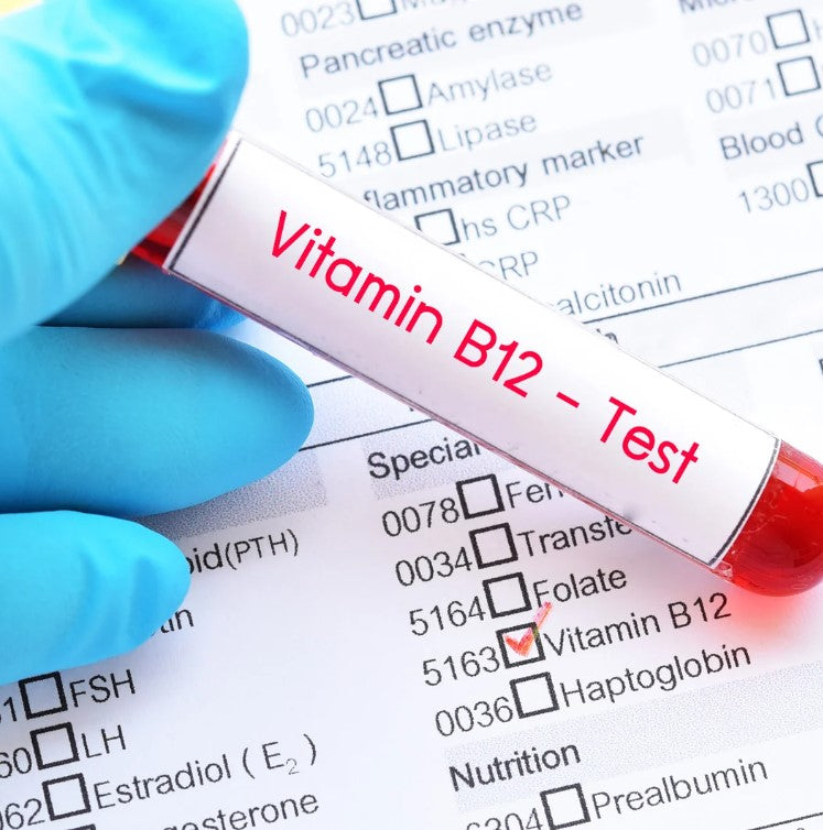 AWH Vitamin D + B12 Check